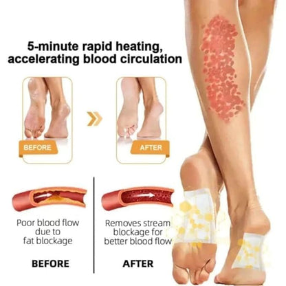 Bee Vesom Lymphatic Daiamage & Sliming Patches (10 Patches)